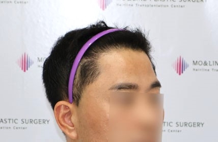치료후기 이미지